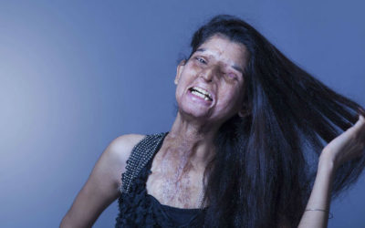 Iran: attaques à l’acide contre des femmes « mal voilées »